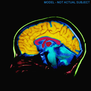 What causes depression?